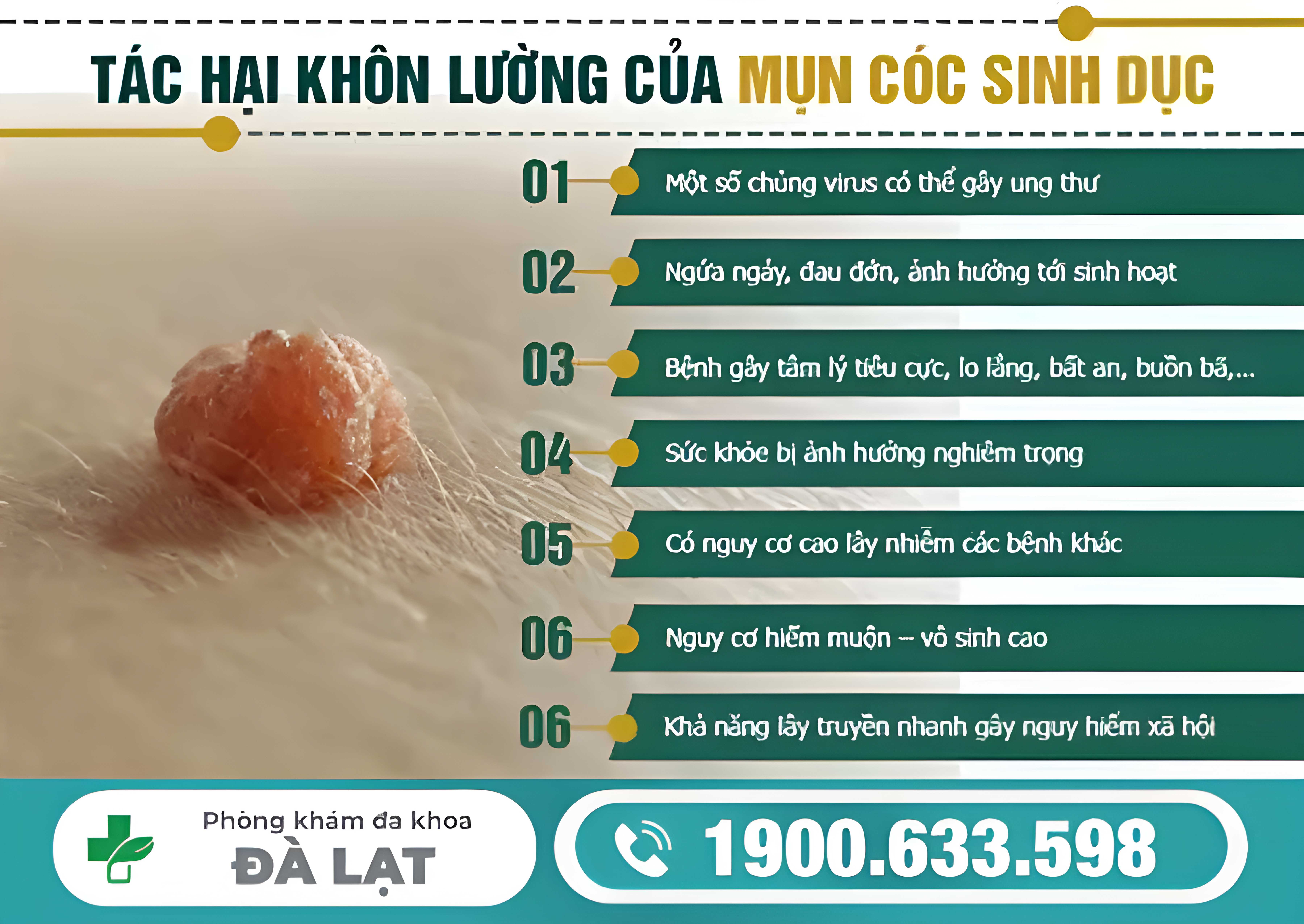 Hình ảnh minh họa
